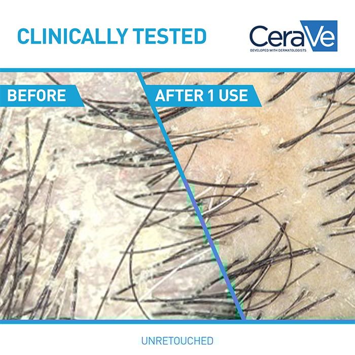 2-in-1 Anti-Dandruff Hydrating Shampoo and Conditioner - Image 4