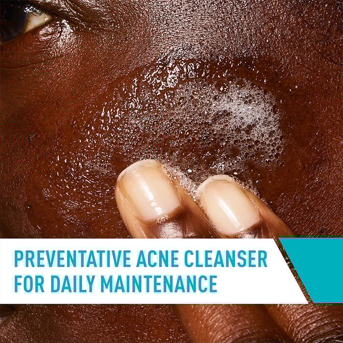 Acne Control Cleanser - Image 4
