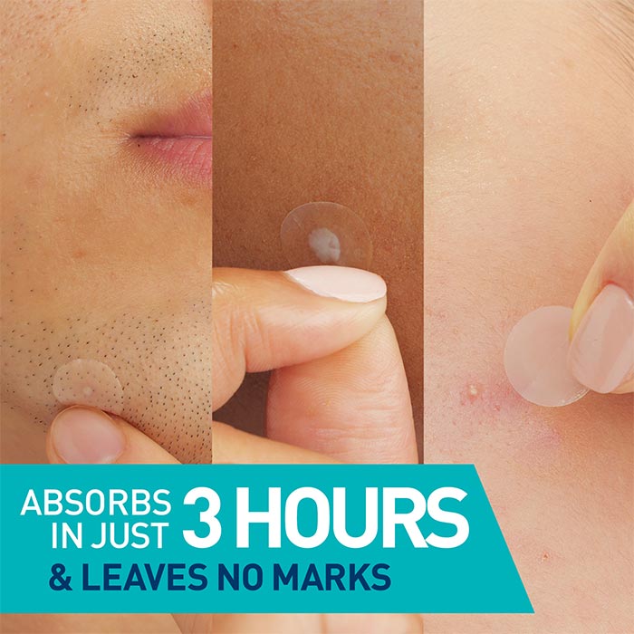 Blemish Barrier Patches - Image 2