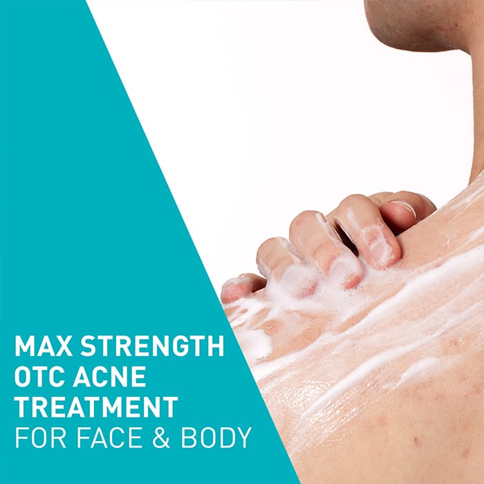 Acne Foaming Cream Wash - Image 5