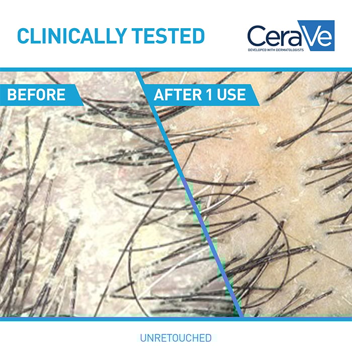 Anti-Dandruff Hydrating Conditioner - Image 4