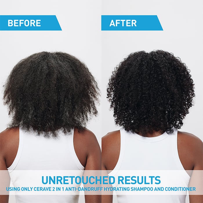 2-in-1 Anti-Dandruff Hydrating Shampoo and Conditioner - Image 5