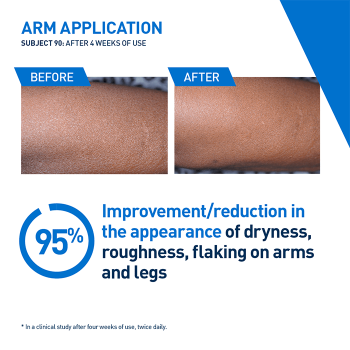 Intensive Moisturizing Lotion - Image 5