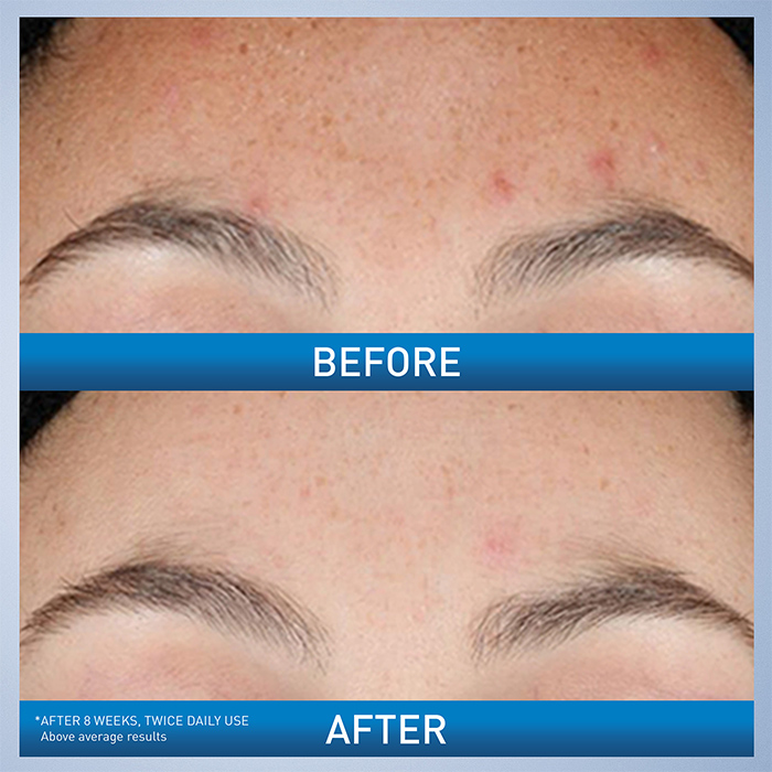 Resurfacing Retinol Serum - Image 3